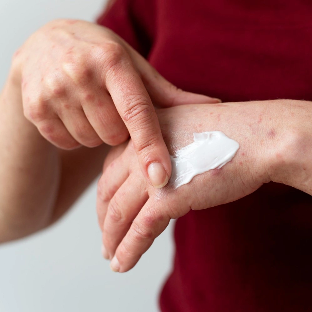 Diabetic Dermopathy Pictures and Visual Identification